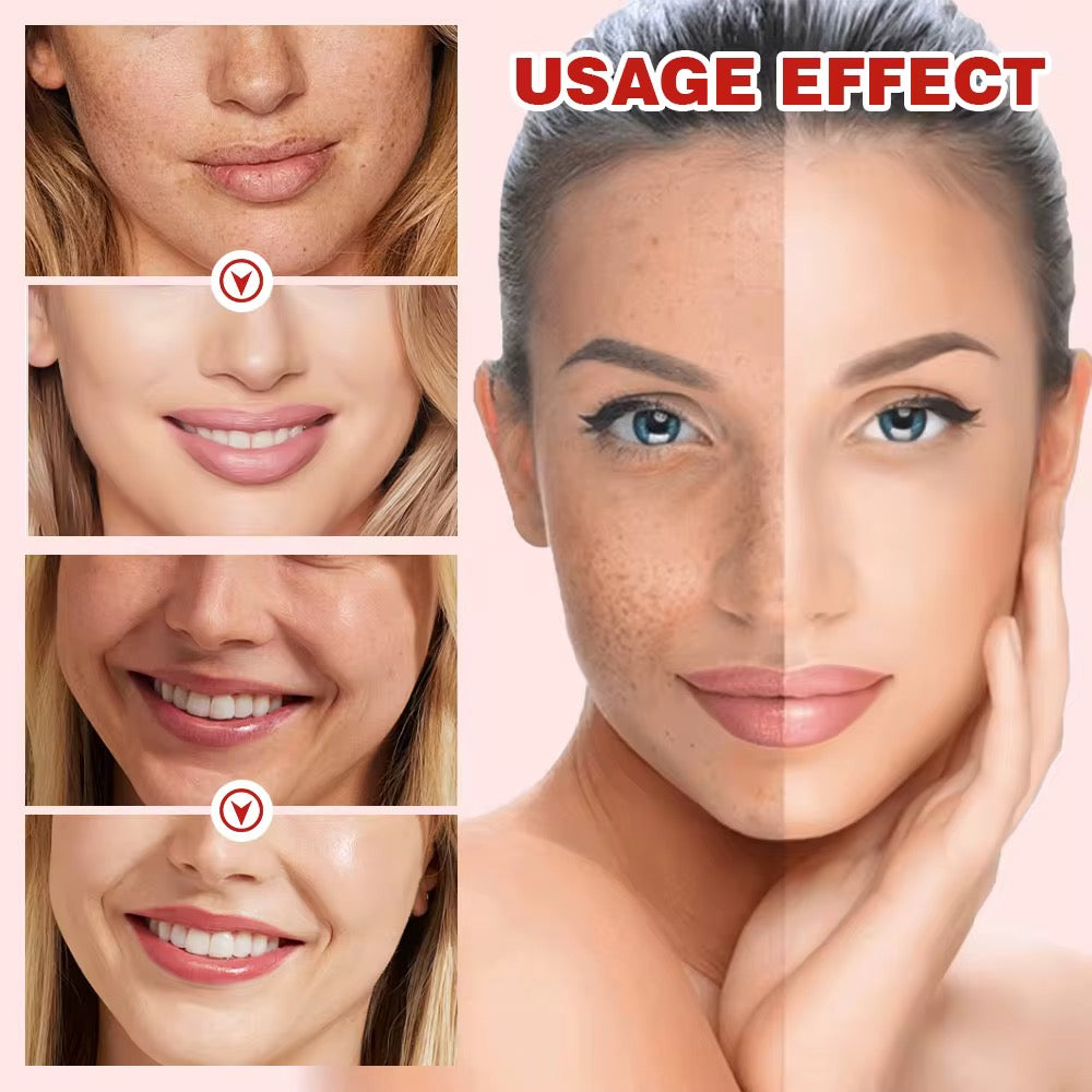 Sérum XUEYI à la niacinamide 10% et à l'acide tranexamique 4% pour éliminer les taches brunes
5.0