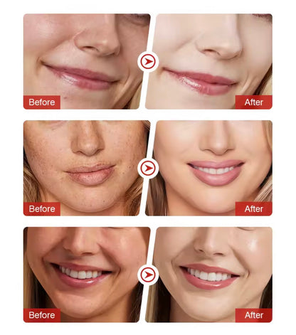 Sérum XUEYI à la niacinamide 10% et à l'acide tranexamique 4% pour éliminer les taches brunes
5.0