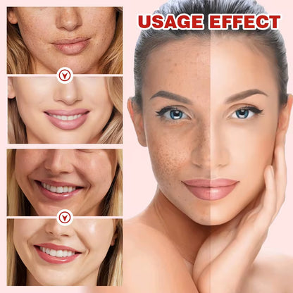 Sérum XUEYI à la niacinamide 10% et à l'acide tranexamique 4% pour éliminer les taches brunes
5.0